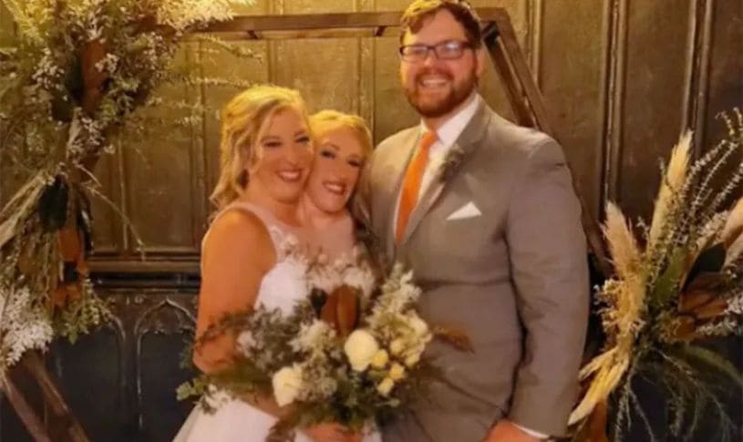 Conjoined Twins Abby And Brittany Hensel